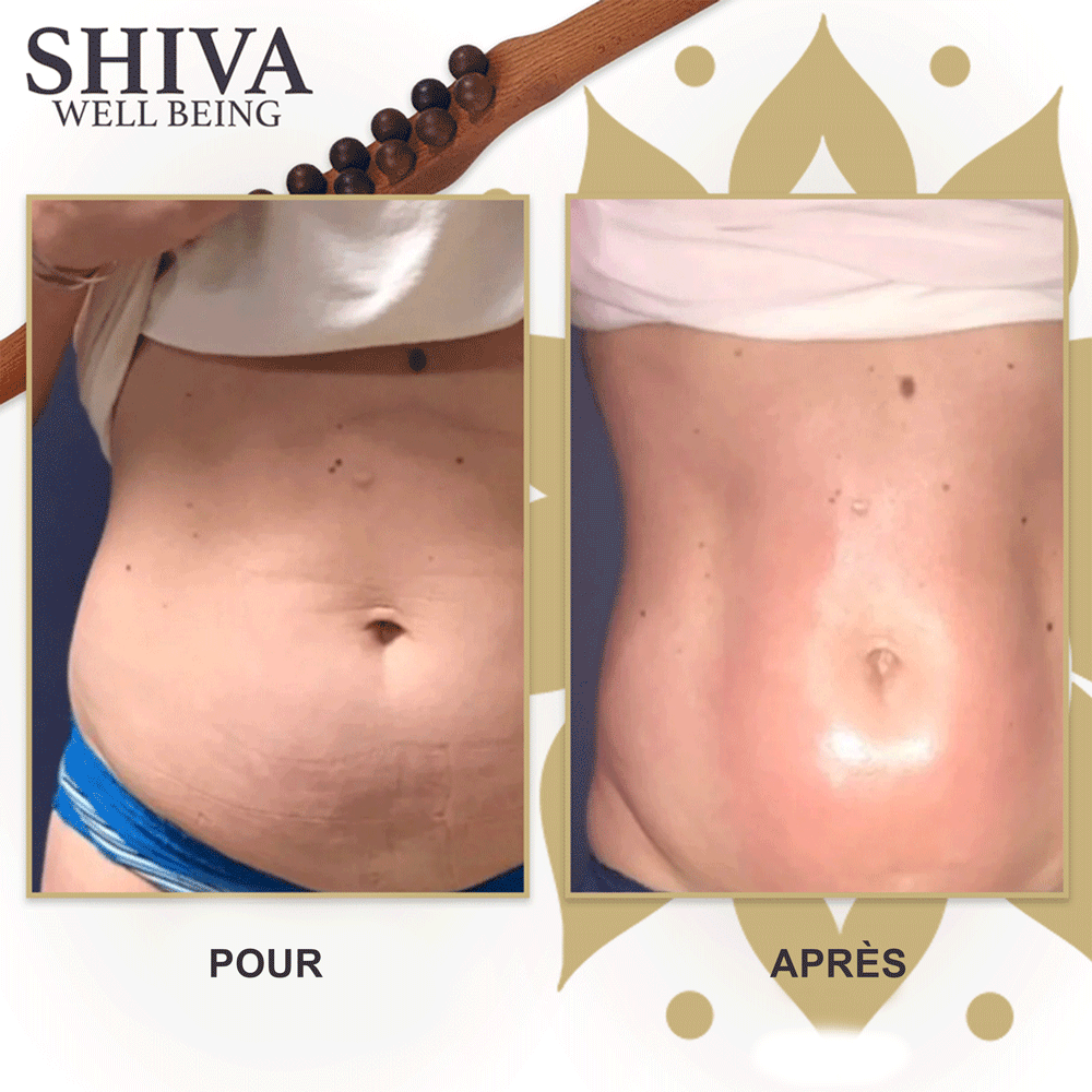Shiva™ Gua Sha Wooden Therapy Bar
